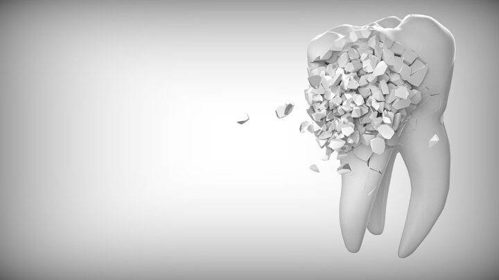 Protezy zębów ruchome