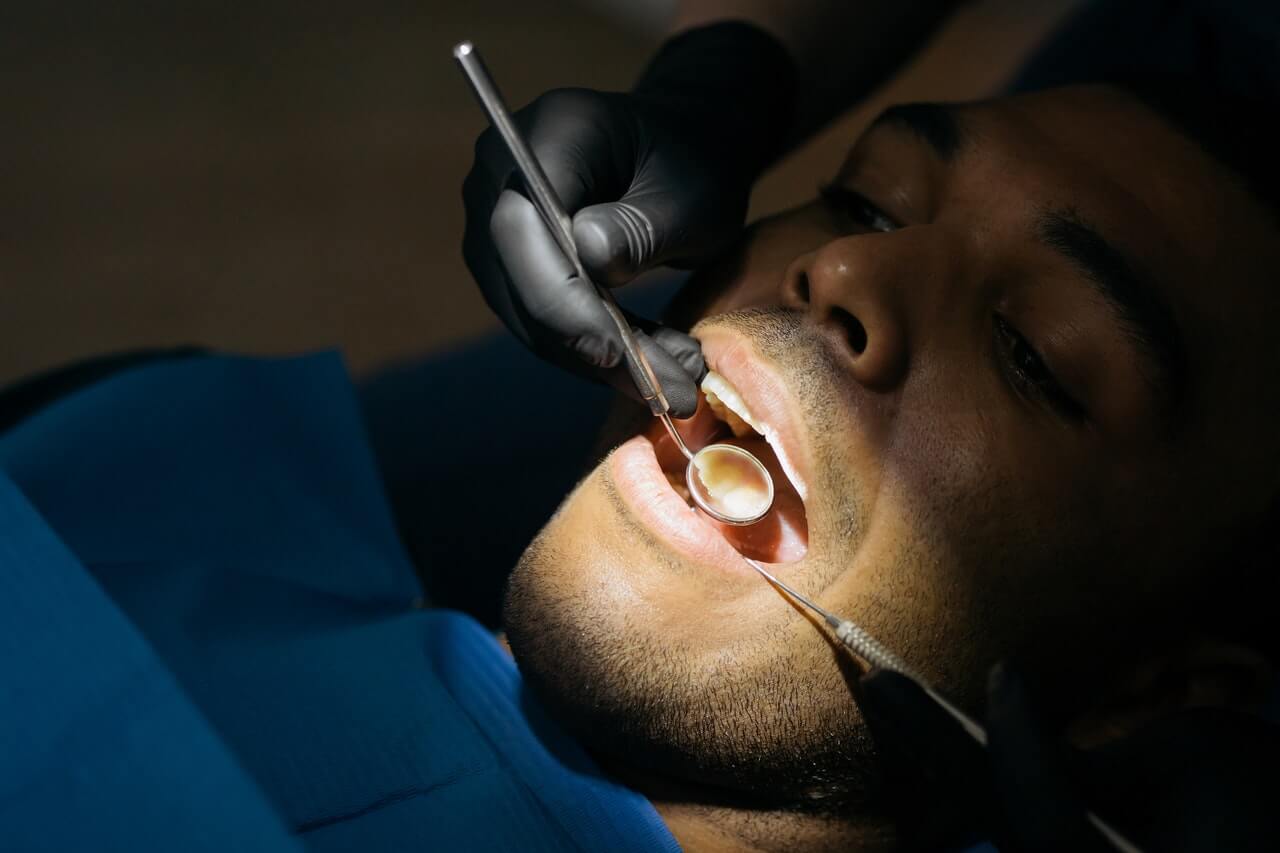 Resekcja wierzchołka korzenia zęba